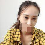 隆鼻+雙眼皮手術(shù)讓我成功蛻變，顏值達到巔峰