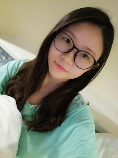 海南添美整形外科醫(yī)生王曉軍做自體軟骨隆鼻+雙眼皮+祛眼袋案例效果對比圖