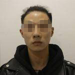 做完隆鼻失敗修復(fù)手術(shù)，再看自己儼然屬于超模中的一員了