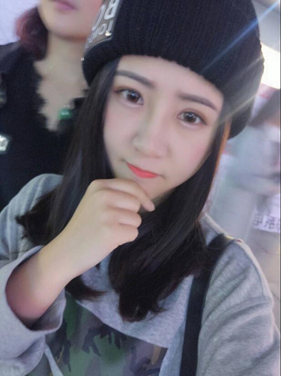 海南添美整形外科醫(yī)生王曉軍做自體軟骨隆鼻+雙眼皮+祛眼袋案例效果對比圖