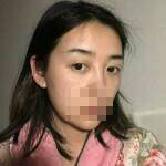 做完雙眼皮手術(shù)眼睛更加迷人了，眼睛自己會撩小哥哥