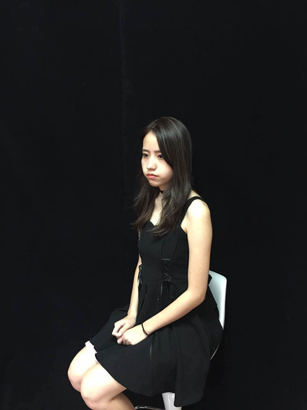 佛山曙光金子醫(yī)學整形醫(yī)生劉洲尉做埋線隆鼻技術怎么樣？附案例