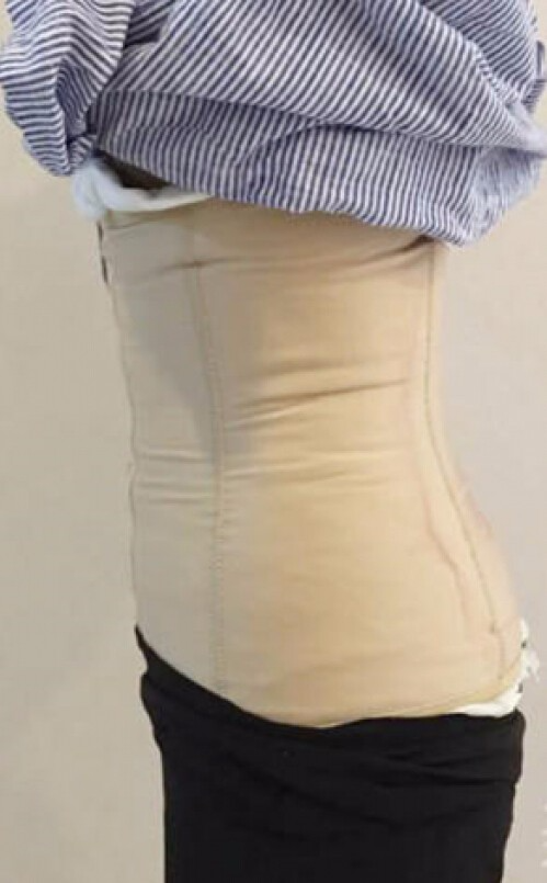 合肥壹加壹整形醫(yī)生周福田做腰腹吸脂技術(shù)怎么樣？附腰腹吸脂案例