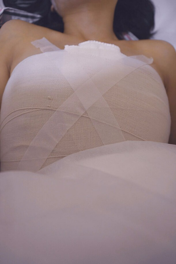 邯鄲凱潤(rùn)婷整形醫(yī)生馬戰(zhàn)勝做自體脂肪隆胸怎么樣？ 附馬戰(zhàn)勝自體脂肪隆胸案例