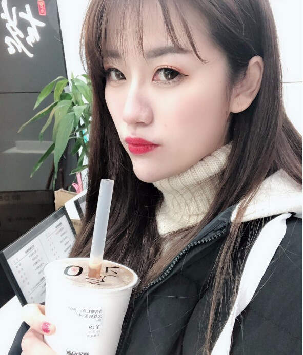 成都藝星醫(yī)療美容醫(yī)院陳遠琨醫(yī)生做注射肉毒素瘦臉效果怎么樣？附案例