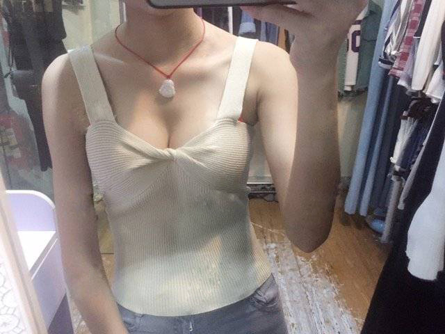 嘉興華山醫(yī)療美容醫(yī)院做假體隆胸怎么樣？嘉興華山陳榮忠假體隆胸案例