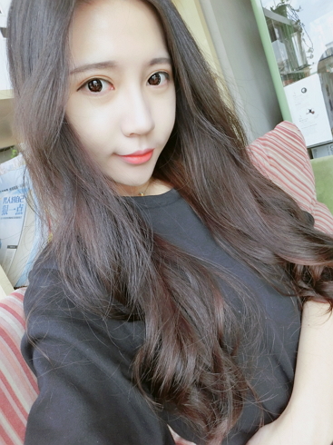  濟(jì)南安美醫(yī)療整形醫(yī)生李思思做下頜角整形怎么樣？李思思下頜角整形案例