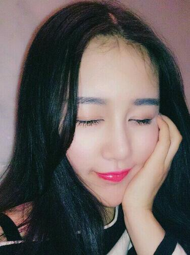 漢中韓美整形醫(yī)生常雙模假體隆鼻+耳軟骨墊鼻尖真實(shí)案例效果圖