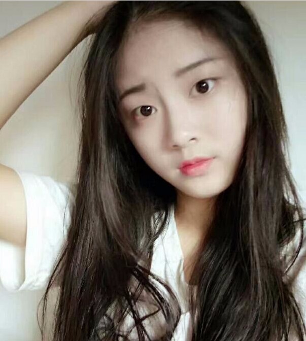 福州愛美爾整形黃林勝雙眼皮案例效果對(duì)比圖 福州愛美爾整形黃林勝雙眼皮案例效果對(duì)比圖