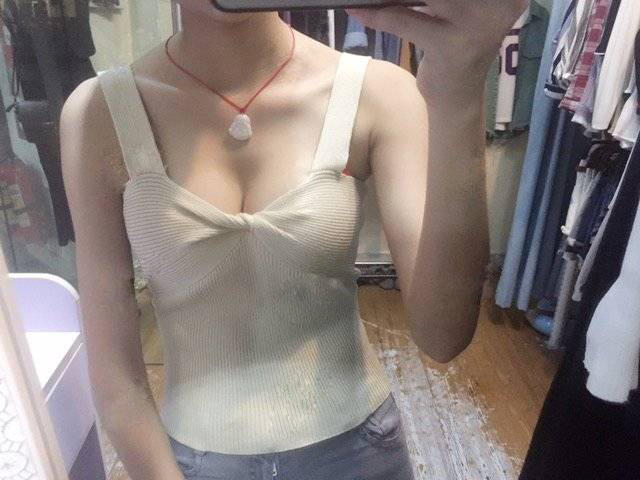 嘉興華山陳榮忠假體隆胸案例 嘉興華山陳榮忠假體隆胸案例