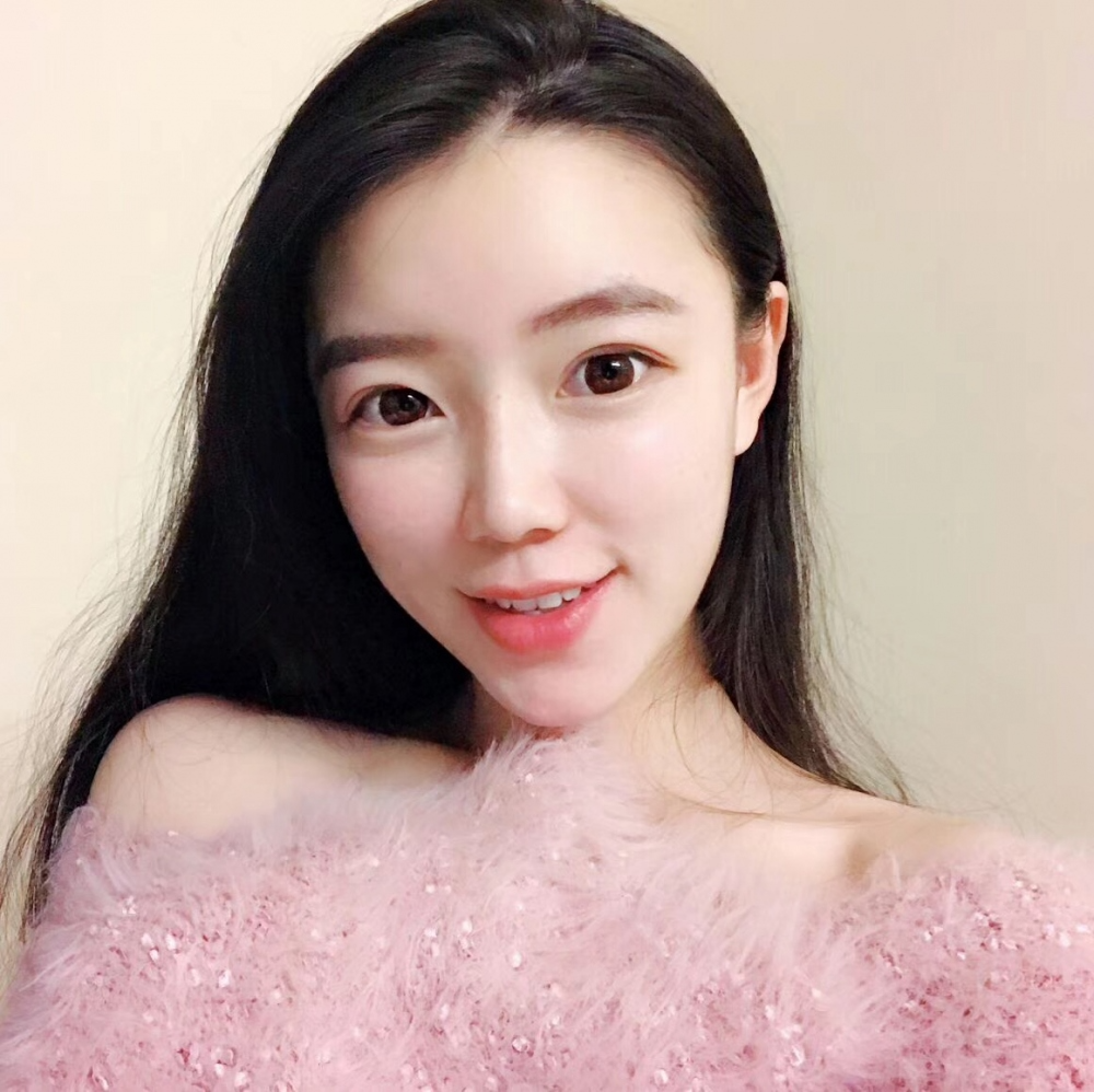 山西伊特雅整形醫(yī)生王鳳芹自體脂肪豐面頰+V-LINE瓜子臉手術案例效果圖