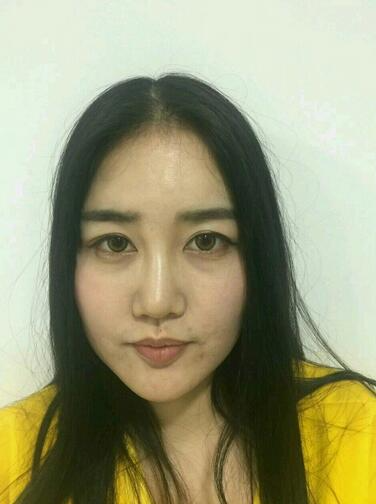 漢中韓美整形醫(yī)生常雙模假體隆鼻+耳軟骨墊鼻尖真實(shí)案例效果圖