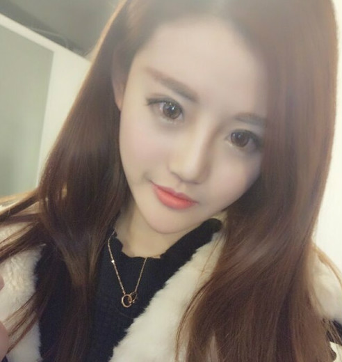 下頜角磨骨八個(gè)月后