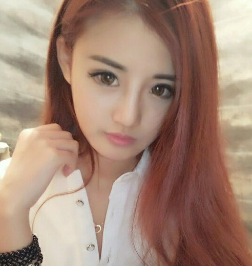 深圳鵬愛整形醫(yī)院湯月碧醫(yī)生做下頜角磨骨怎么樣？附下頜角磨骨案例