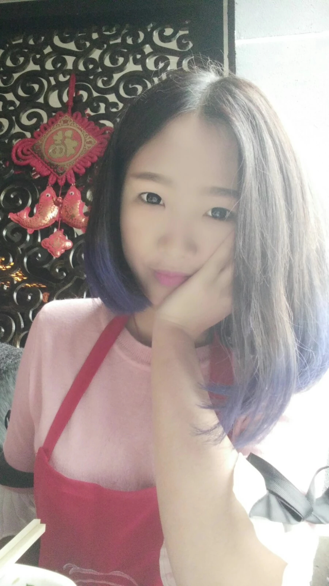 西安米蘭柏羽整形醫(yī)院李旭平做切開雙眼皮效果怎么樣？附案例