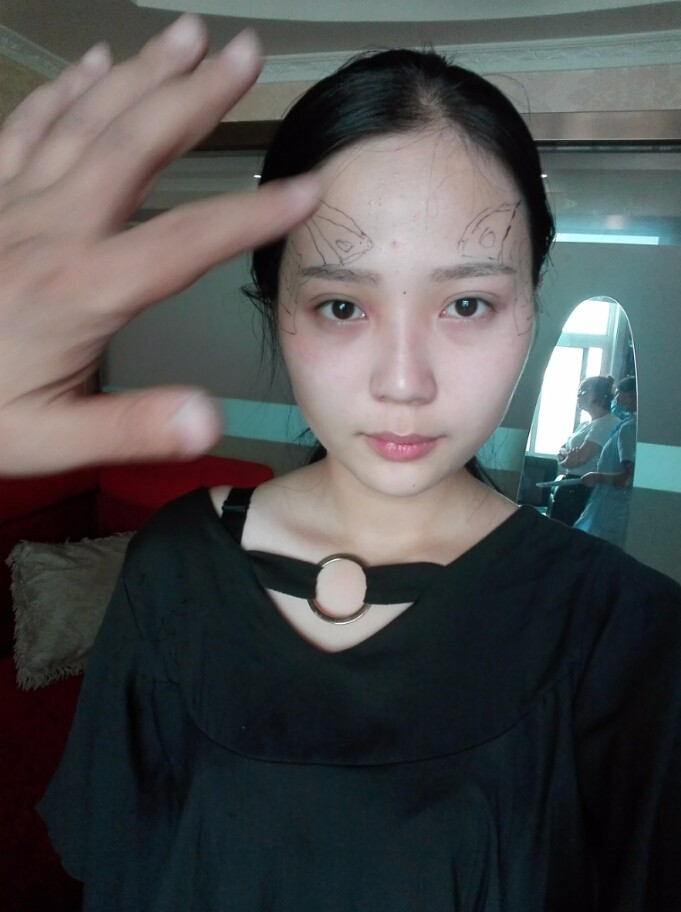 西安華仁醫(yī)院整形美容中心做自體脂肪填充效果怎么樣？附耿延鵬整形案例