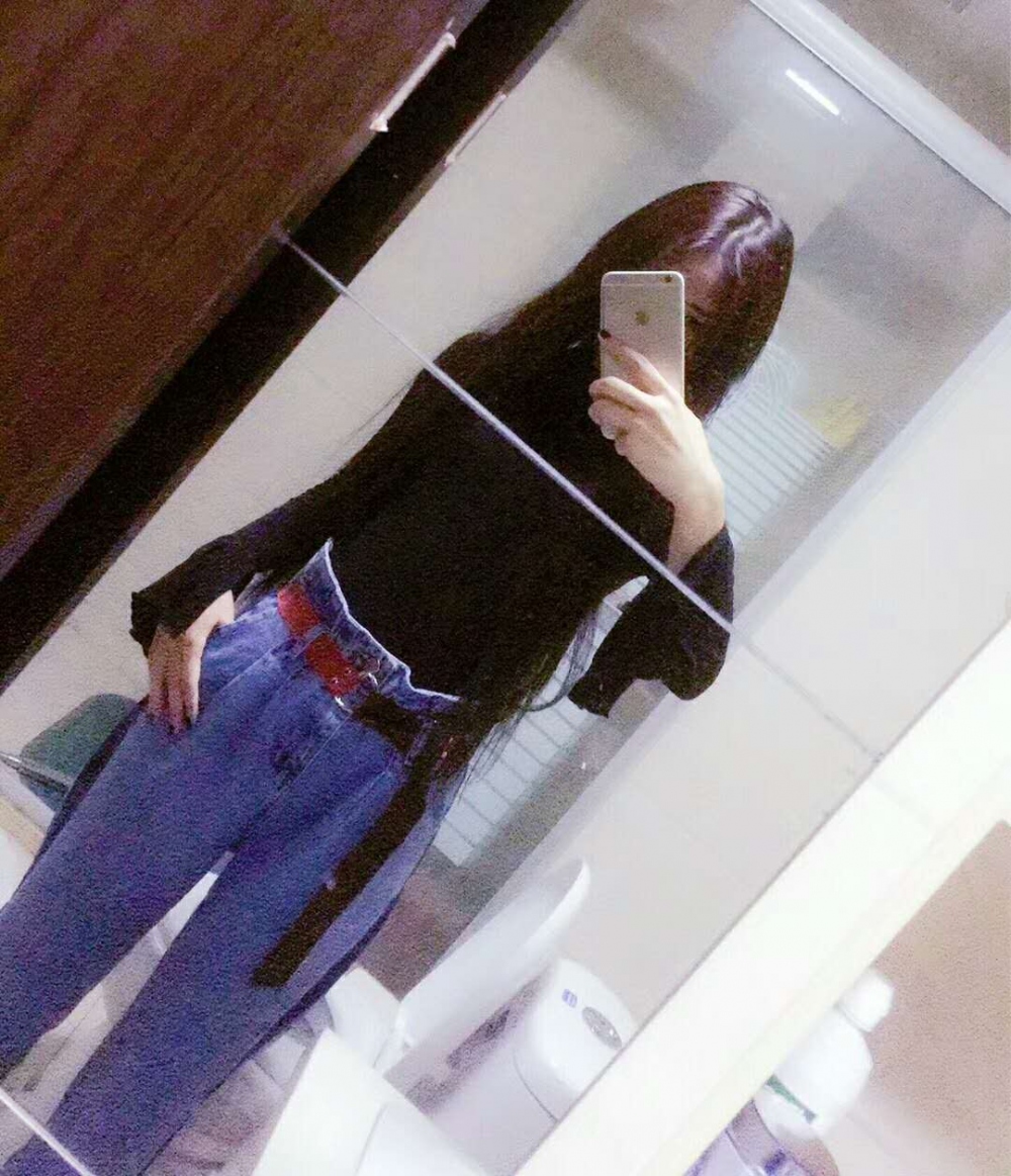 埋線提升去法令紋效果圖