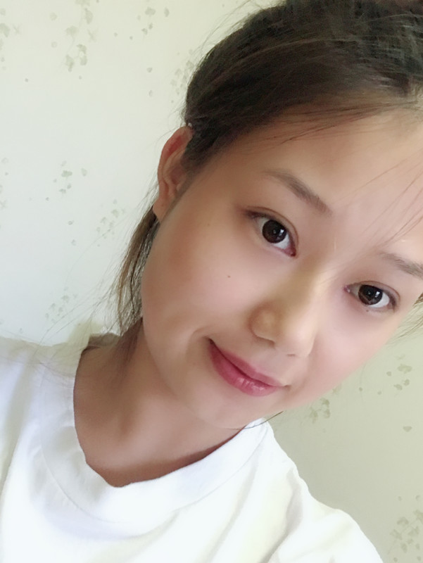 西安藝星整形醫(yī)院徐智慧醫(yī)生做埋線提升怎么樣？附西安藝星埋線提升案例