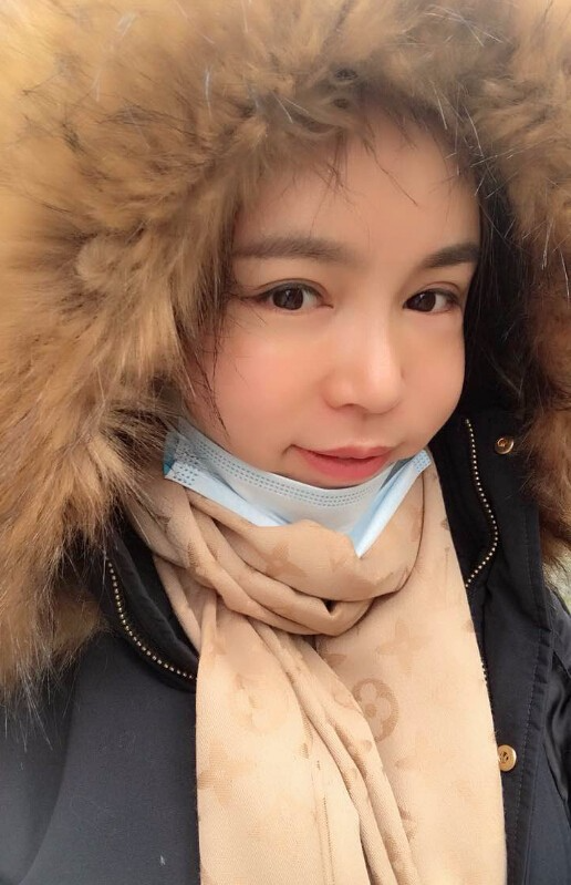 重慶聯(lián)合麗格美容醫(yī)院林麗蓉醫(yī)生做自體脂肪豐蘋(píng)果肌怎么樣？附案例