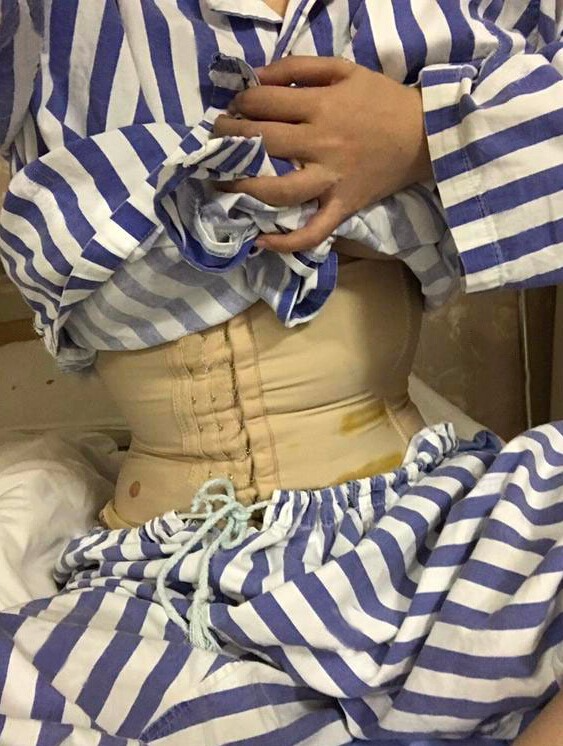 長(zhǎng)沙亞韓醫(yī)學(xué)整形醫(yī)生米勒做腰腹吸脂效果怎么樣？米勒腰腹吸脂案例