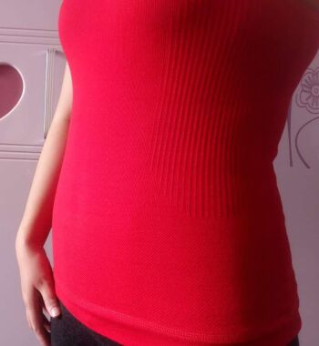 武漢東方麗人醫(yī)院整形美容科胡江偉醫(yī)生做腰腹吸脂案例效果對(duì)比圖