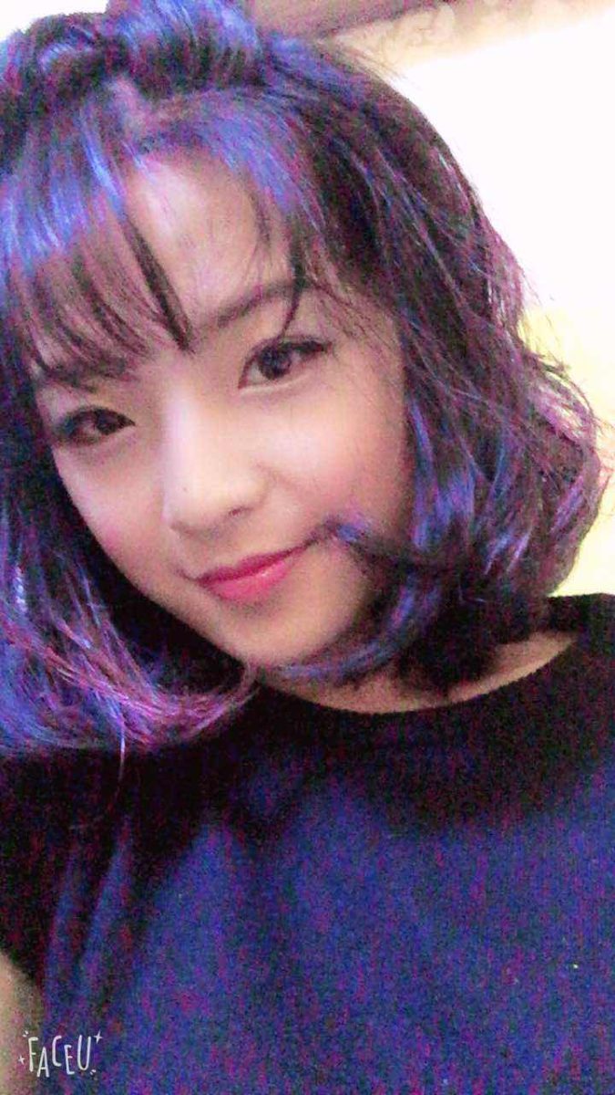 鄭州名門整形醫(yī)院董斌醫(yī)生做下頜角整形怎么樣？附下頜角整形案例