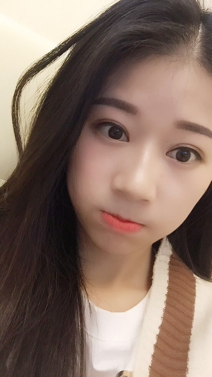 深圳晨曦醫(yī)療整形醫(yī)生吉米斯做切開雙眼皮怎么樣？吉米斯切開雙眼皮案例效果