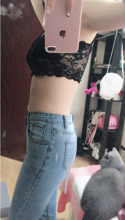 長(zhǎng)沙亞韓醫(yī)學(xué)整形醫(yī)生米勒做腰腹吸脂效果怎么樣？米勒腰腹吸脂案例