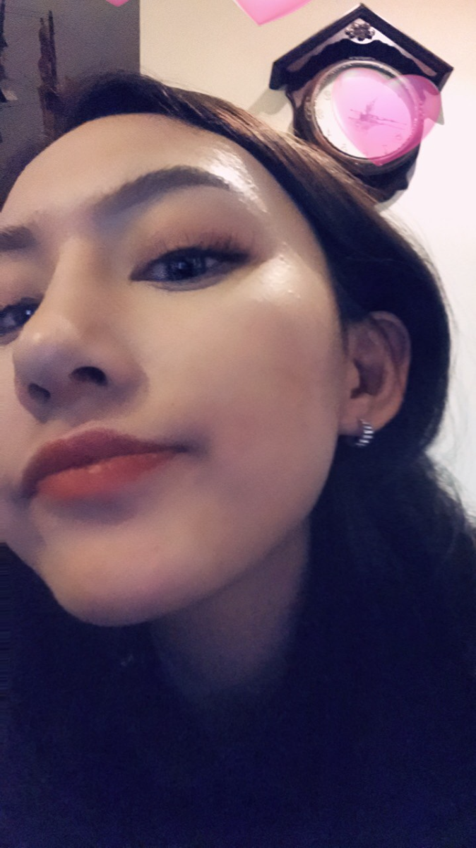 煙臺洛神醫(yī)學美容醫(yī)院張瑞允醫(yī)生做硅膠隆鼻怎么樣？附硅膠隆鼻案例