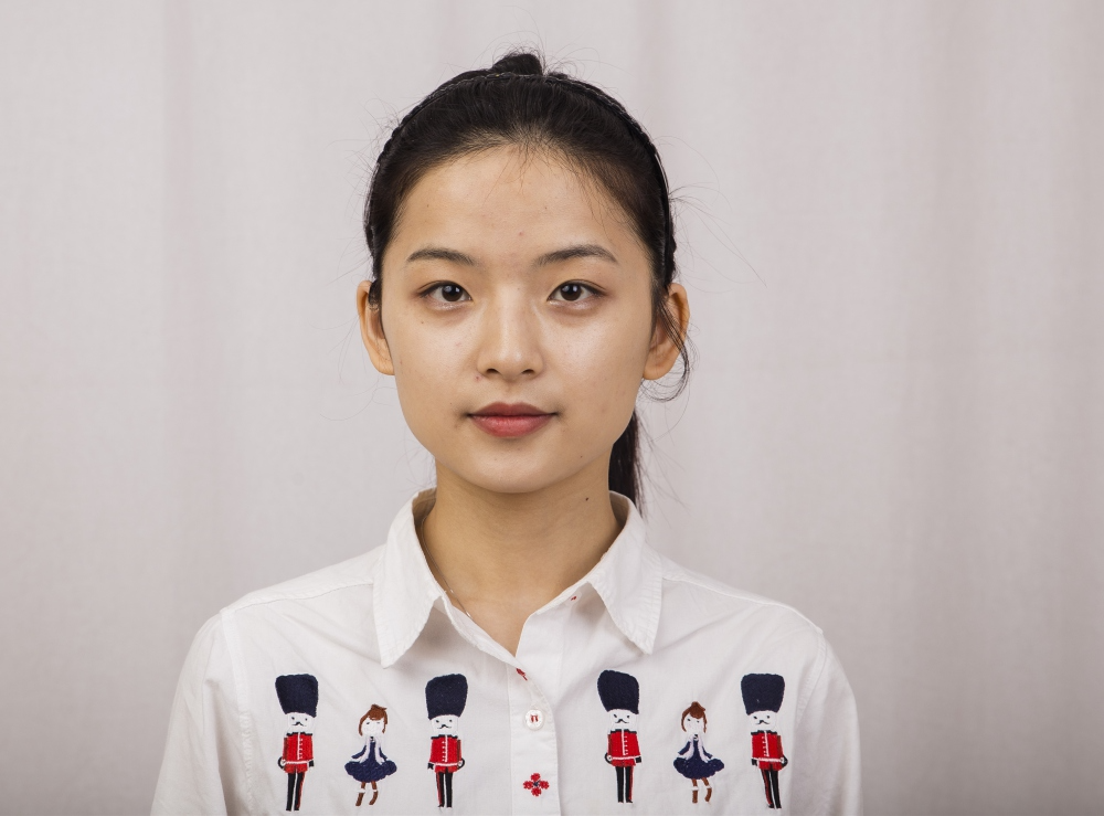 鄭州名門整形醫(yī)院董斌醫(yī)生做下頜角整形怎么樣？附下頜角整形案例