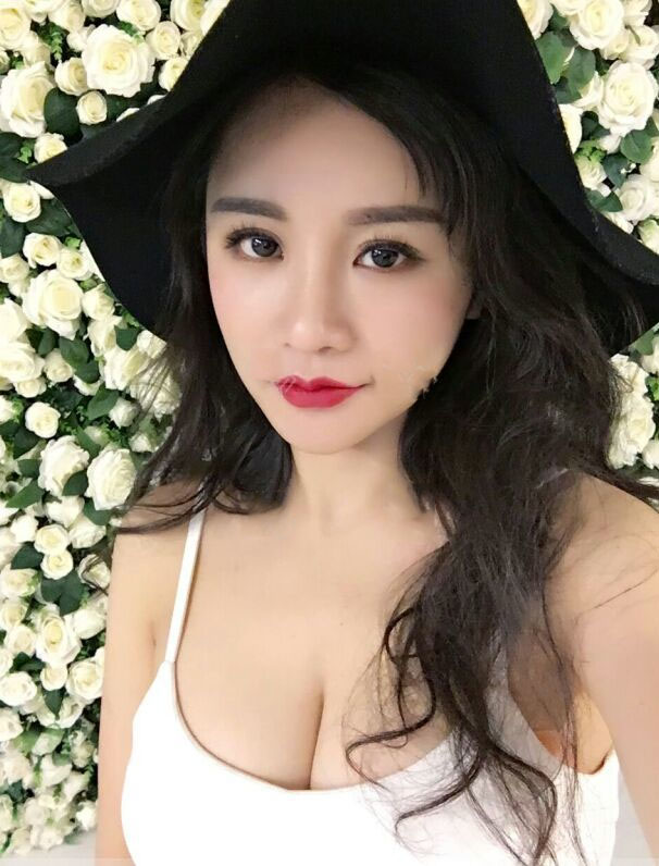 海南韓美醫(yī)學(xué)美容醫(yī)院李強(qiáng)醫(yī)生做自體脂肪隆胸效果怎么樣？附案例