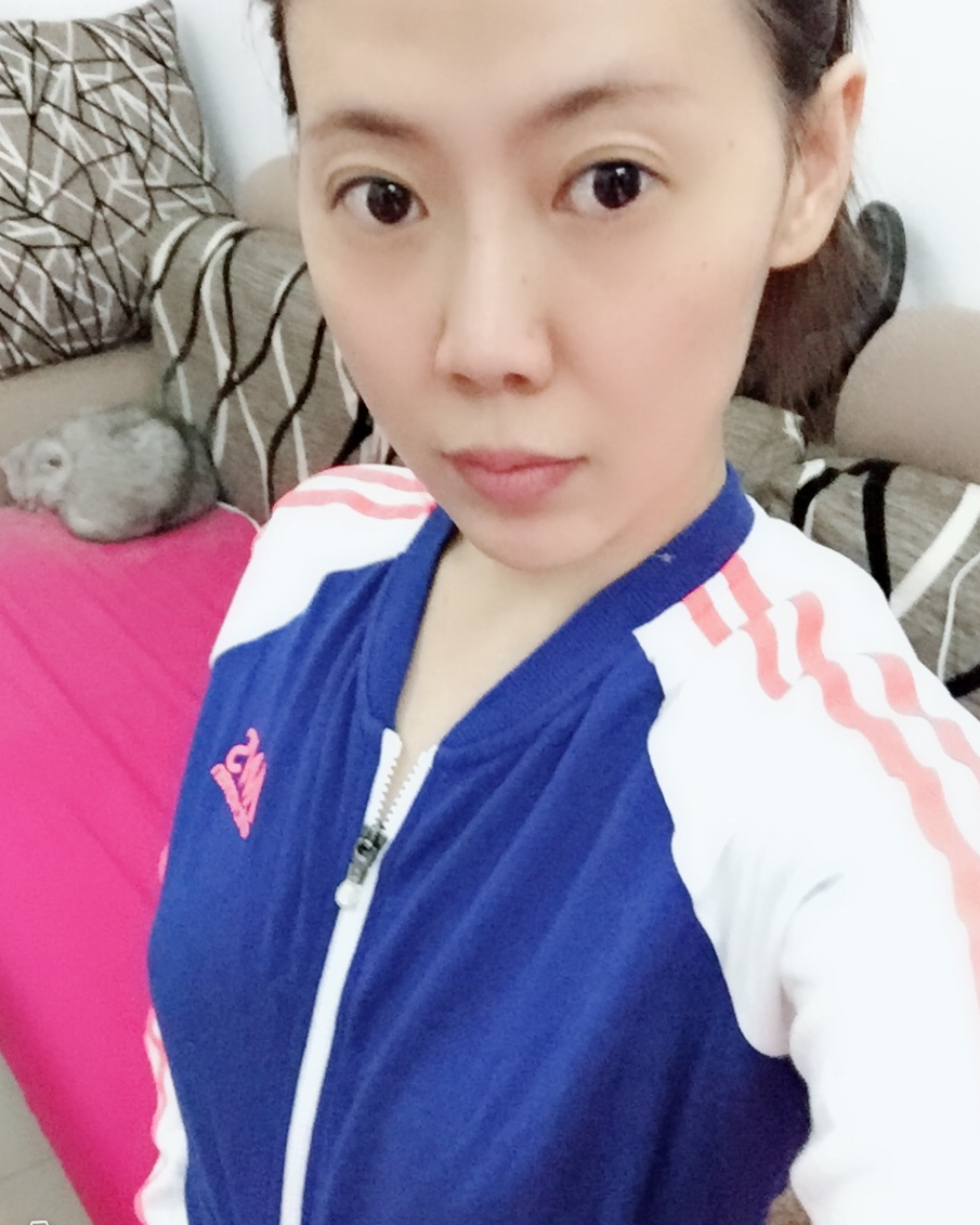 煙臺壹美整形醫(yī)院朱建瑩醫(yī)生做自體脂肪隆胸怎么樣？附自體脂肪隆胸案例