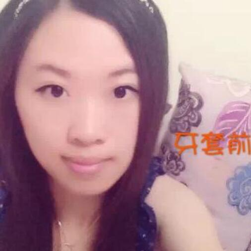 重慶嘉悅口腔醫(yī)院周繼祥醫(yī)生做金屬托槽矯正效果怎么樣？附案例效果對比圖