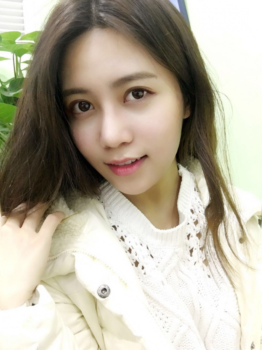 重慶美圣美邦整形醫(yī)院劉力維醫(yī)生做自體脂肪全臉填充案例效果對比圖