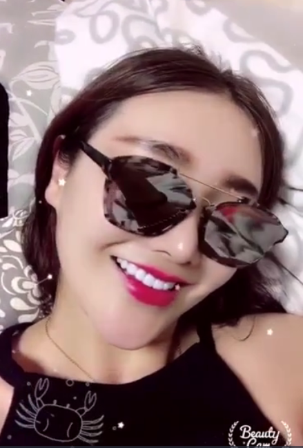 廣州柏德口腔蘭海龍醫(yī)生做瓷貼面效果怎么樣？廣州柏德口腔瓷貼面案例分享