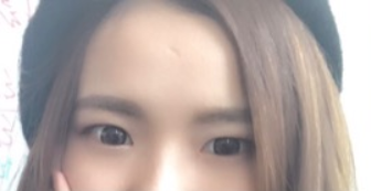 長春麥西美嘉整形醫(yī)生王圣博做雙眼皮手術(shù)效果怎么樣？附雙眼皮案例