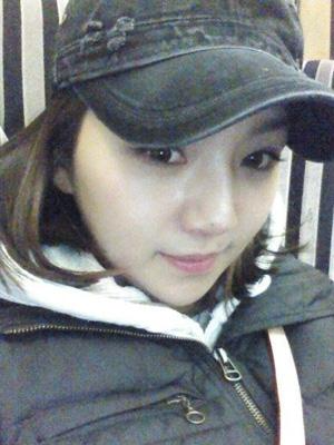 長春中妍整形醫(yī)院吳學軍醫(yī)生做玻尿酸墊下巴+玻尿酸豐太陽穴案例效果對比圖