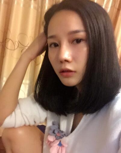 西安陽光整形醫(yī)院邵萍醫(yī)生做鼻綜合整形怎么樣？附鼻綜合整形案例