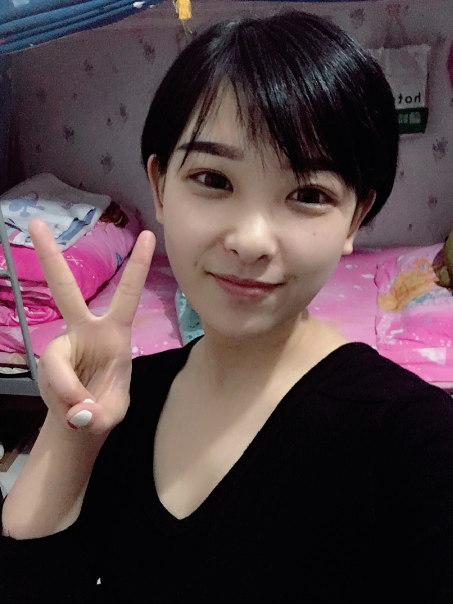 武漢肽慕醫(yī)美整形醫(yī)院楊婉菱醫(yī)生做面部吸脂效果怎么樣？附面部吸脂案例