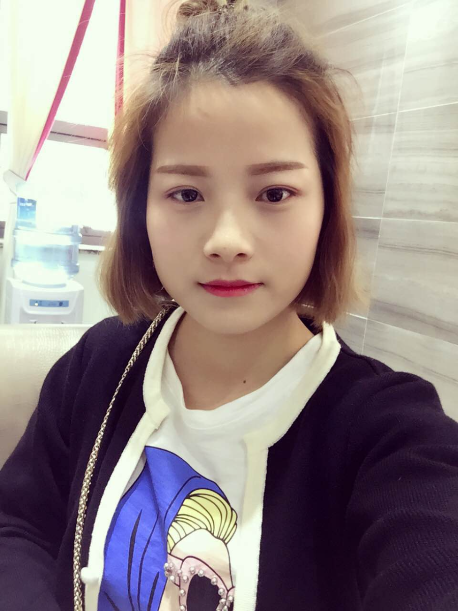 西安藝星醫(yī)療整形醫(yī)院李國玲做鼻綜合整形怎么樣？附李國玲鼻綜合整形案例