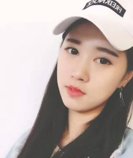 北京亞奧整形醫(yī)生程金龍做韓式三點雙眼皮+開內(nèi)眼角效果怎么樣？