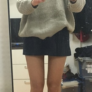 株洲雅美醫(yī)療整形醫(yī)生車旺做大腿吸脂效果怎么樣？附案例效果對(duì)比圖