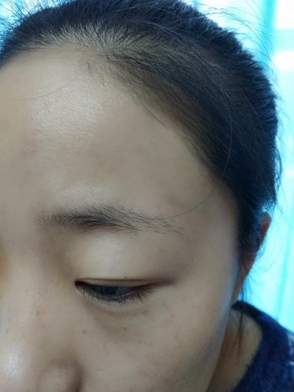 長沙愛思特醫(yī)療美容醫(yī)院做半永久紋眉怎么樣？附彭子娟醫(yī)生案例效果圖