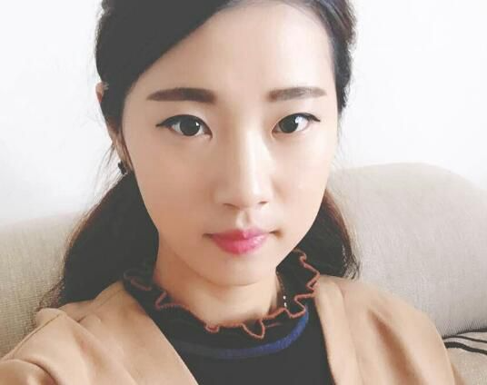 北京亞奧整形醫(yī)生程金龍做韓式三點雙眼皮+開內(nèi)眼角效果怎么樣？