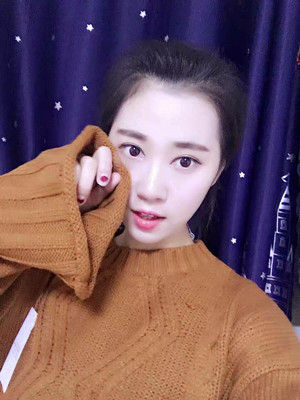 北京貴美匯整形醫(yī)院上田寬醫(yī)生做雙眼皮案例效果對比圖