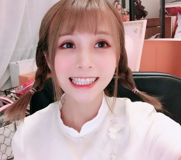 廣州德倫口腔醫(yī)生程武做隱形托槽矯正怎么樣？附隱形托槽矯正案例效果對比圖