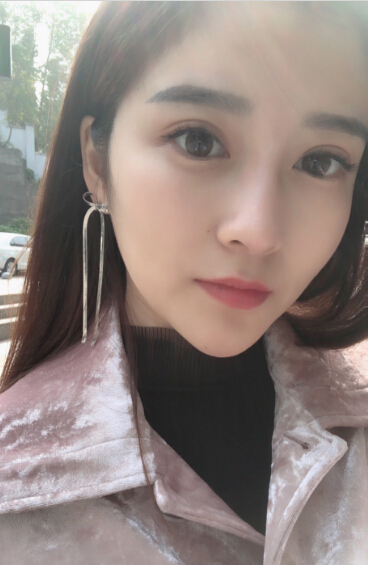 張家港唯恩整形醫(yī)院陳天杰醫(yī)生切開雙眼皮案例效果對比圖