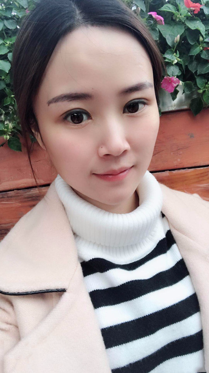 廣東韓妃醫(yī)療美容醫(yī)院做切開(kāi)雙眼怎么樣？附案例效果圖