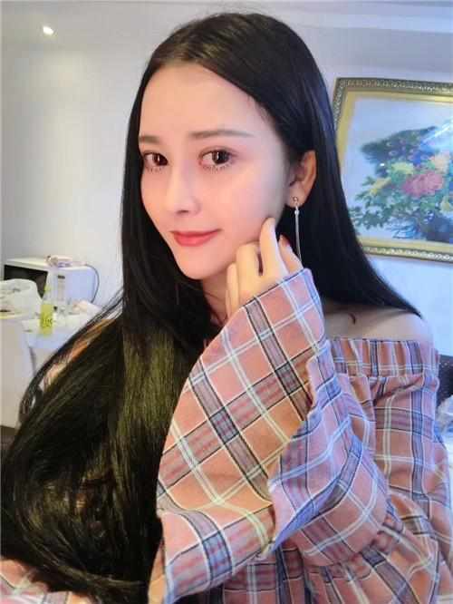 鄭州華領(lǐng)醫(yī)療美容醫(yī)院醫(yī)生張永濤做硅膠假體隆鼻怎么樣？附案例效果對比圖