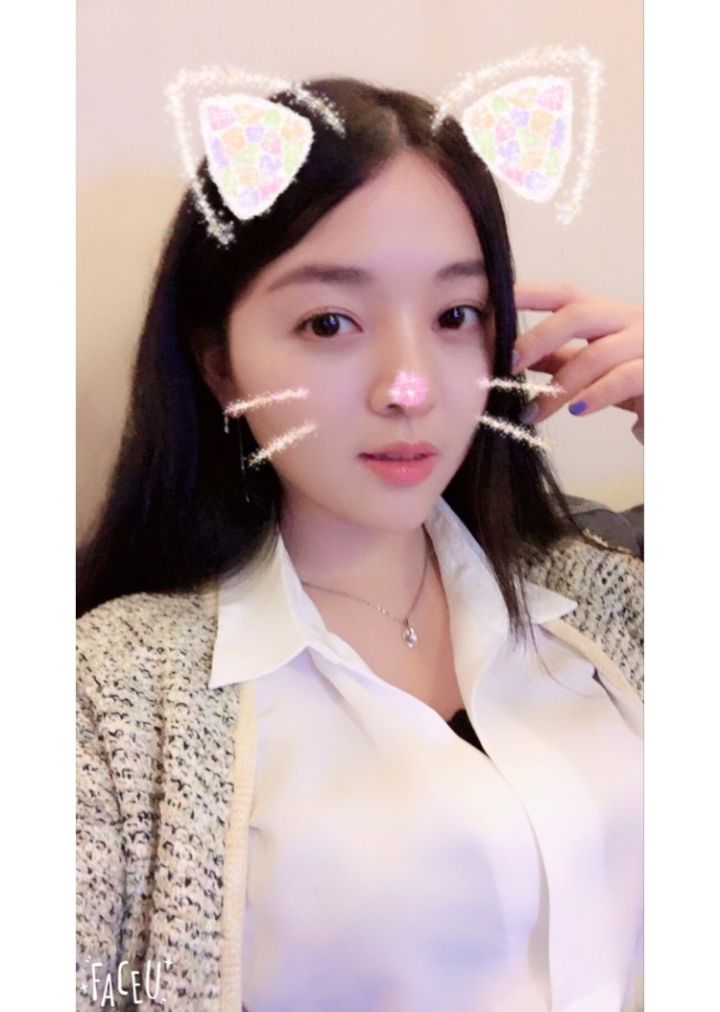 北京京韓整形醫(yī)生王義山做埋線雙眼皮怎么樣？附案例效果對(duì)比圖